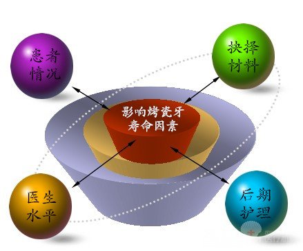 烤瓷牙寿命有多长