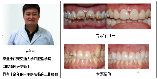 美容冠修复过程