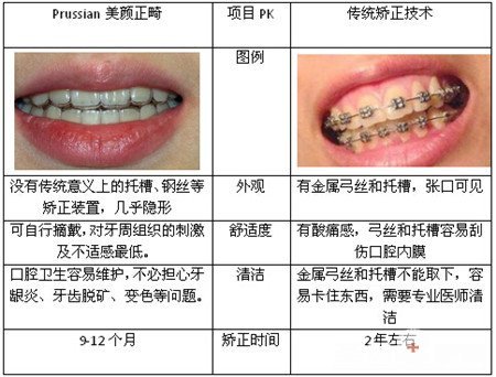 西安做牙齿矫正多少钱