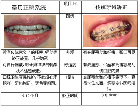 成都龅牙矫正需要多少钱3